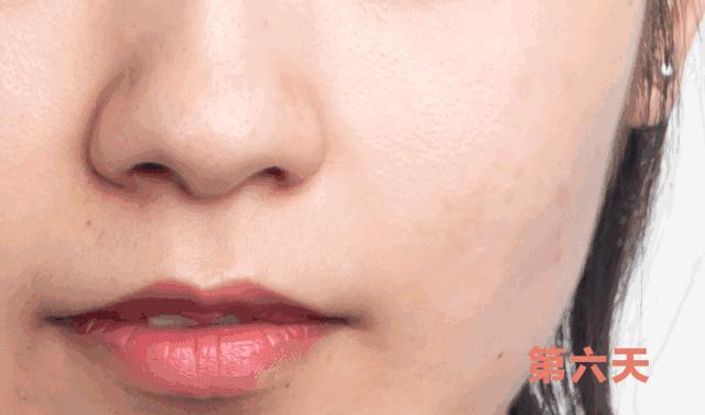 一招帮你搞定淡化法令纹,教你一招二天消除法令纹