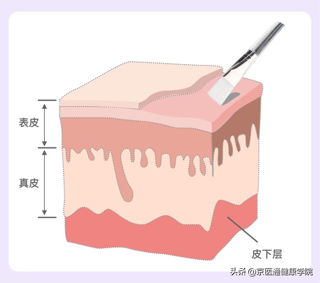 脸色发黄毛孔粗大出油严重怎么办,脸部爱出油长痘毛孔粗大怎么调理