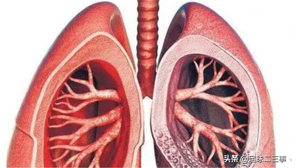 尤文图斯球员新冠,迪巴拉新冠病毒