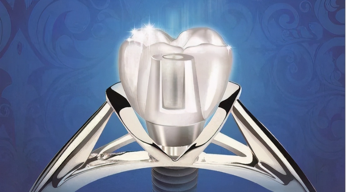 雅悦齿科杨浦雅洁口腔医院,雅悦齿科种牙