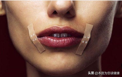 经常烂嘴角是缺什么,经常烂嘴和嘴角发白是缺少什么