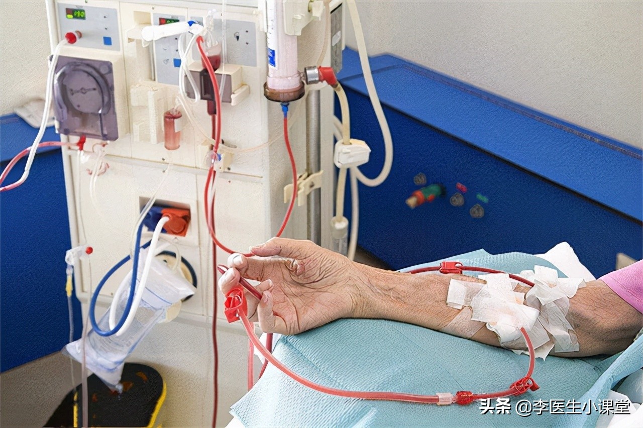 如何保护肾功能避免肾衰竭,肾衰竭怎么做能保护剩下的肾功能