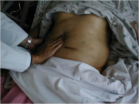 胆结石会引起黄疸腹疼吗,胆结石胆囊炎伴有黄疸应该怎么办