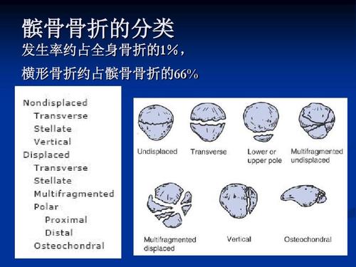 膝盖痛髌骨上方有裂开要手术吗,膝盖髌骨后面突然像针扎一样疼
