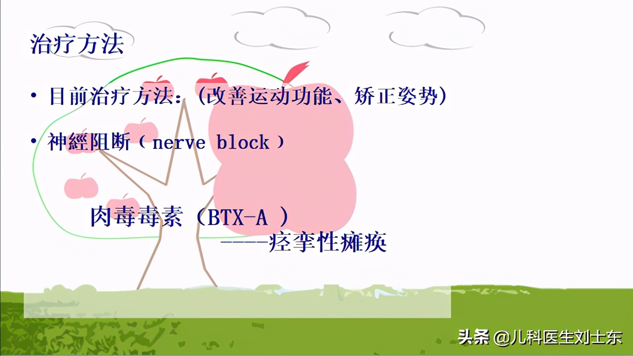 肉毒素治疗脑瘫患儿成功案例,肉毒素治疗脑瘫肌肉痉挛的效果