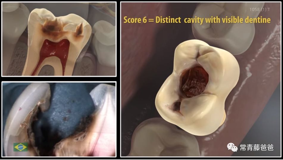 爱牙日保护你的口腔健康,爱牙日从定期口腔检查开始