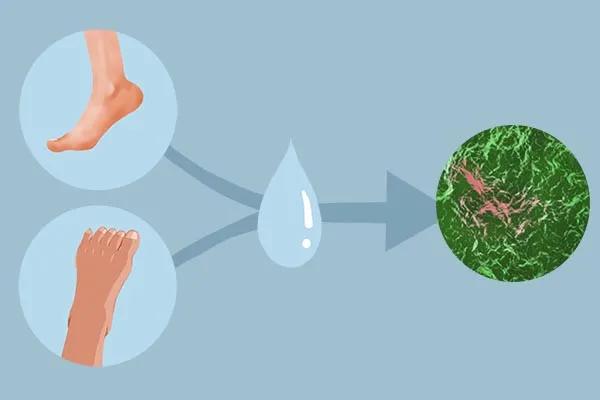 天一热脚就起水泡还痒,天气一暖和脚就开始痒