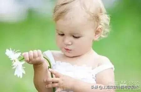 小爱医生---“特应性皮炎”“湿疹”宝宝，想说爱你真的不容易…