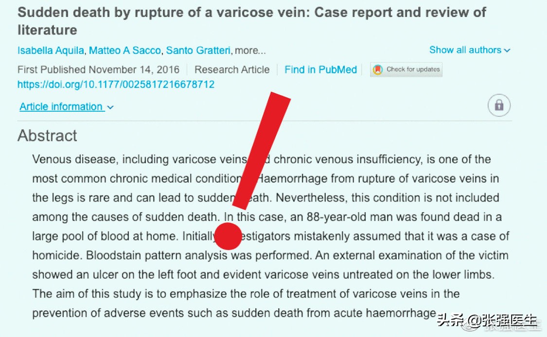 胃静脉曲张破裂前有什么征兆,老人静脉曲张严重怎么治疗最好
