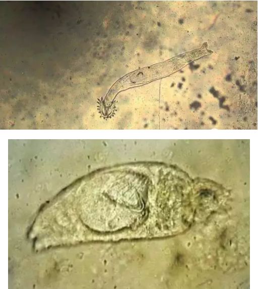 水产镜检虫图片,水产养殖常见虫类图