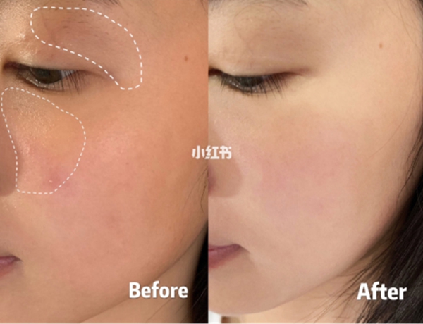 精华液排行榜前十名小蓝瓶薇诺娜,精华液推荐平价补水淡斑抗初老