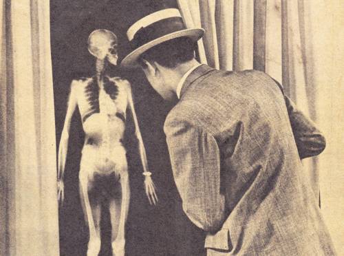 用X光脱毛、试鞋、选美，那些玩X光的勇士最后都怎样了？