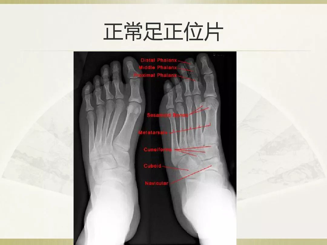 骨科x光片读片技巧,放射科骨科读片教程