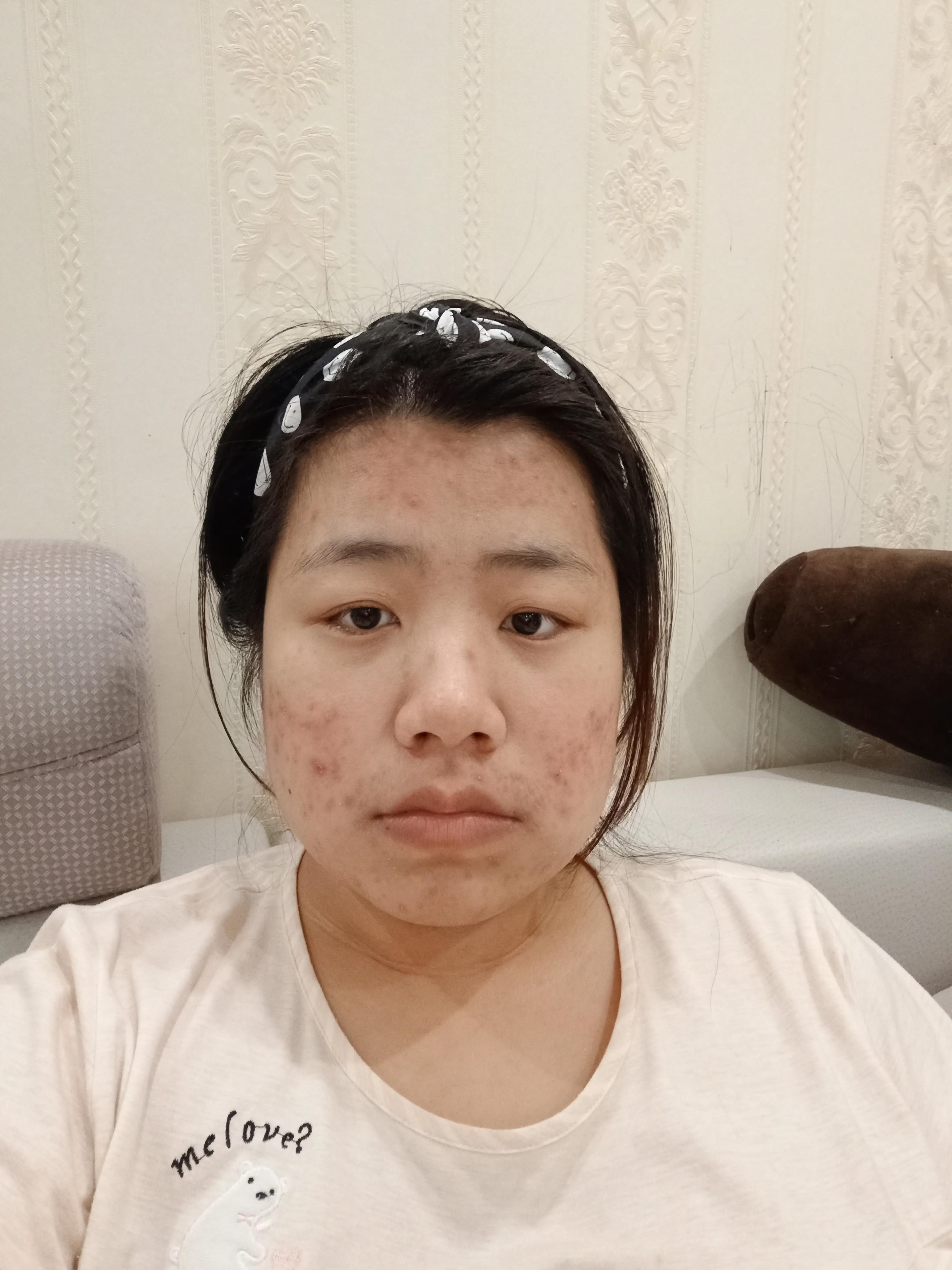 兰蔻极光水真实测评第一名,兰蔻小黑瓶和极光水