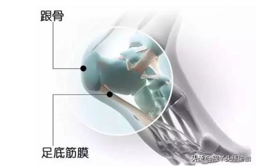 足底筋膜炎有哪些锻炼方法,瑜伽治疗足底筋膜炎