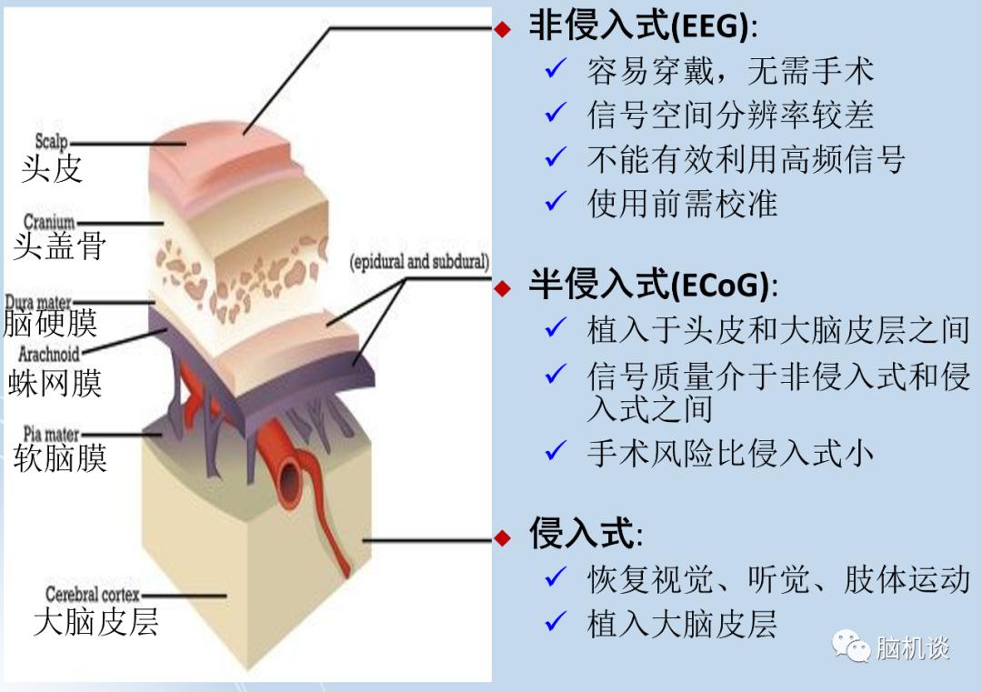 ​《脑机往事（3）—维达尔的秘密》