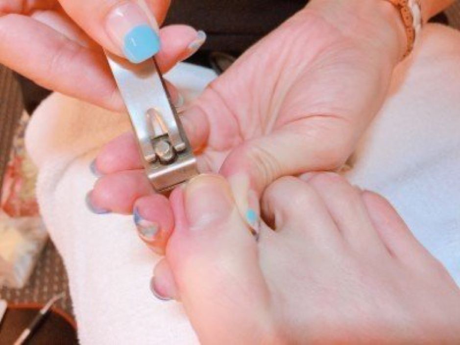 夏天脚气消失冬天脚气又有了,得了脚气香港脚有什么需要注意