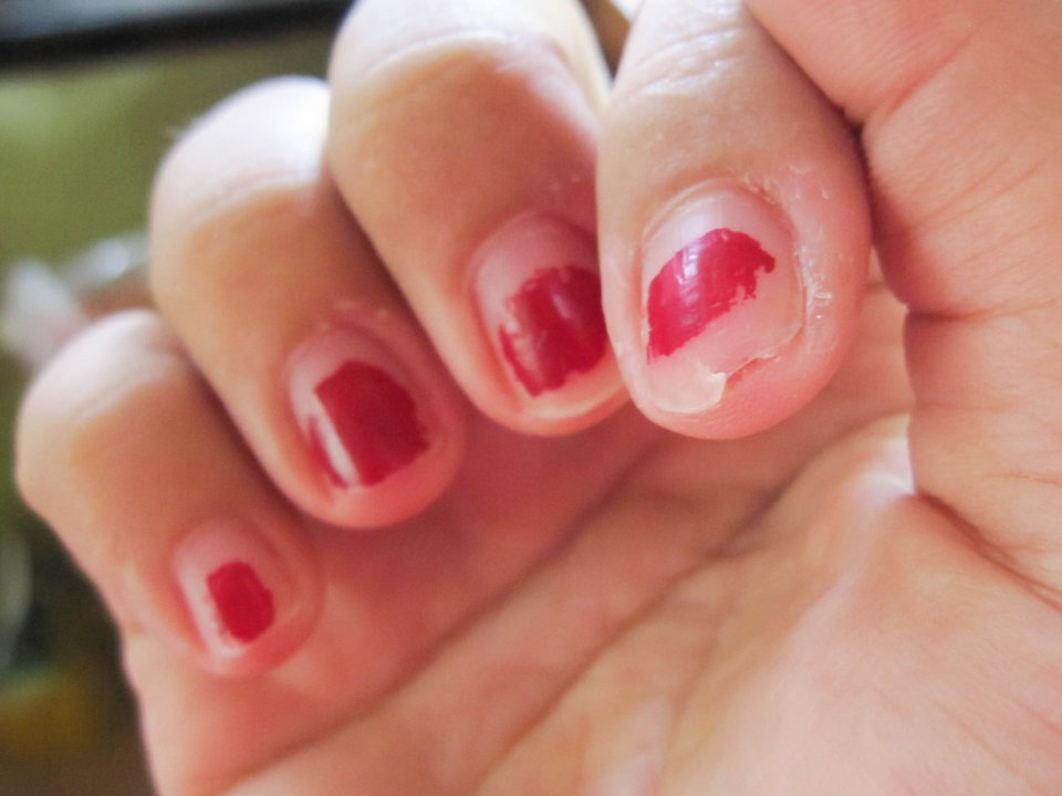 夏日女神们钟爱的美甲安全吗？指甲是如何生长的？医生告诉您