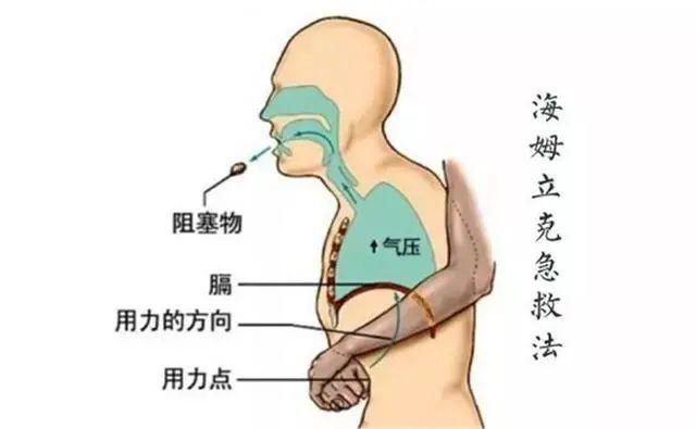 国际急救日掌握一定的急救技能,世界急救日一起get急救技能