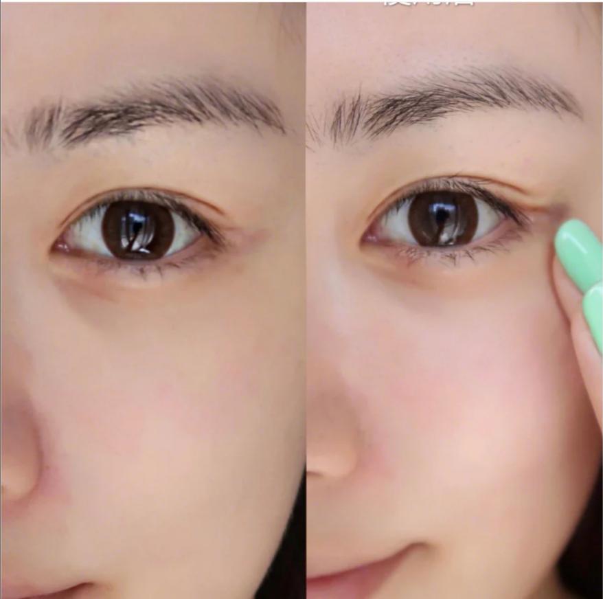 欧莱雅抗衰老眼霜,欧莱雅抗衰老眼霜推荐