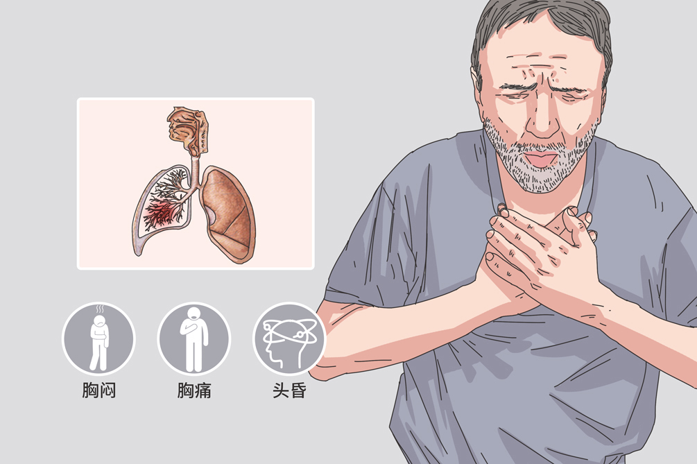 尿素循环障碍可疑什么症状,尿素循环障碍怎么确诊