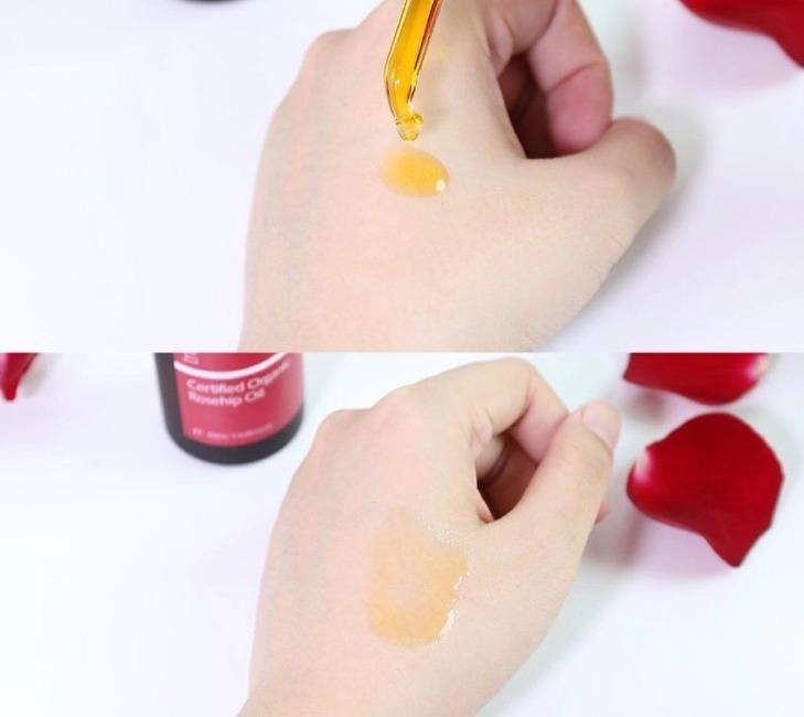 淡化妊娠纹紧致皮肤的精油,玫瑰果油妊娠纹