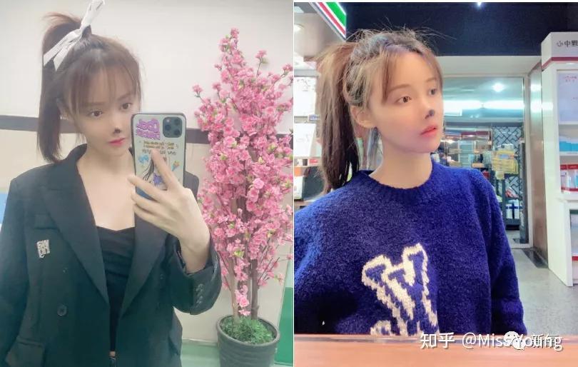 整容自毁前程的女明星,整容失去灵魂的女明星