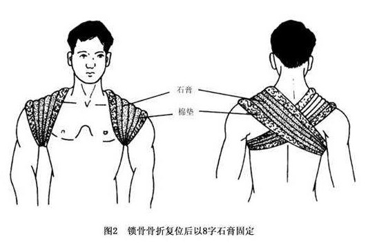 脊椎痛应该如何放松,脊椎损伤怎么快速恢复