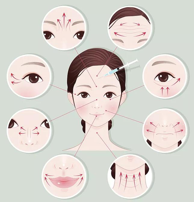 瘦脸针瘦脸详细讲解,瘦脸针瘦脸详细讲解图