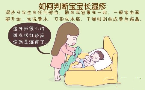 宝宝湿疹一直好不了怎么办,宝宝湿疹反复发作一招解决