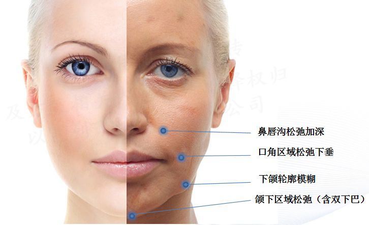 热拉提抗衰,抗衰老的杀手锏热拉提plus