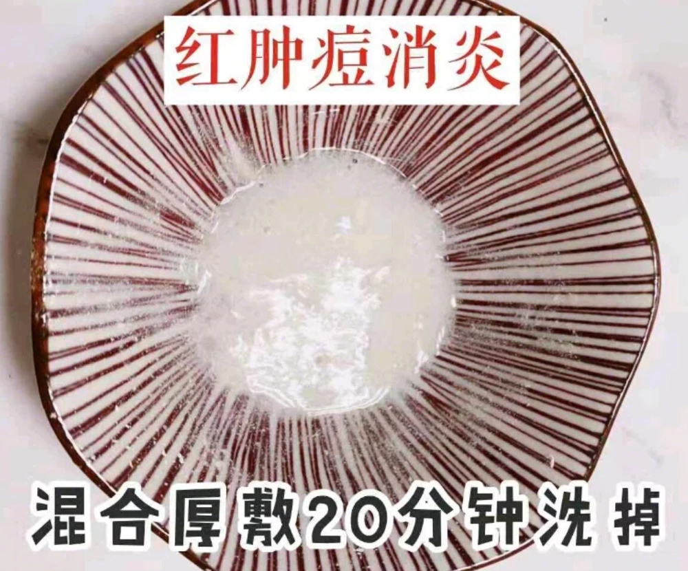 四个亲测有效的祛痘小妙招，坚持一个星期，不用花钱就有好皮肤