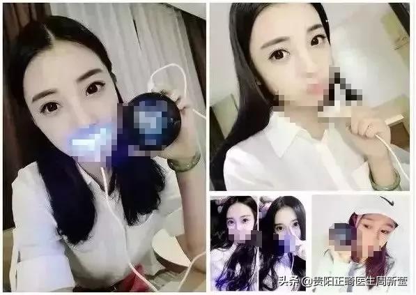 冷光美牙仪的危害,朋友圈冷光美牙仪