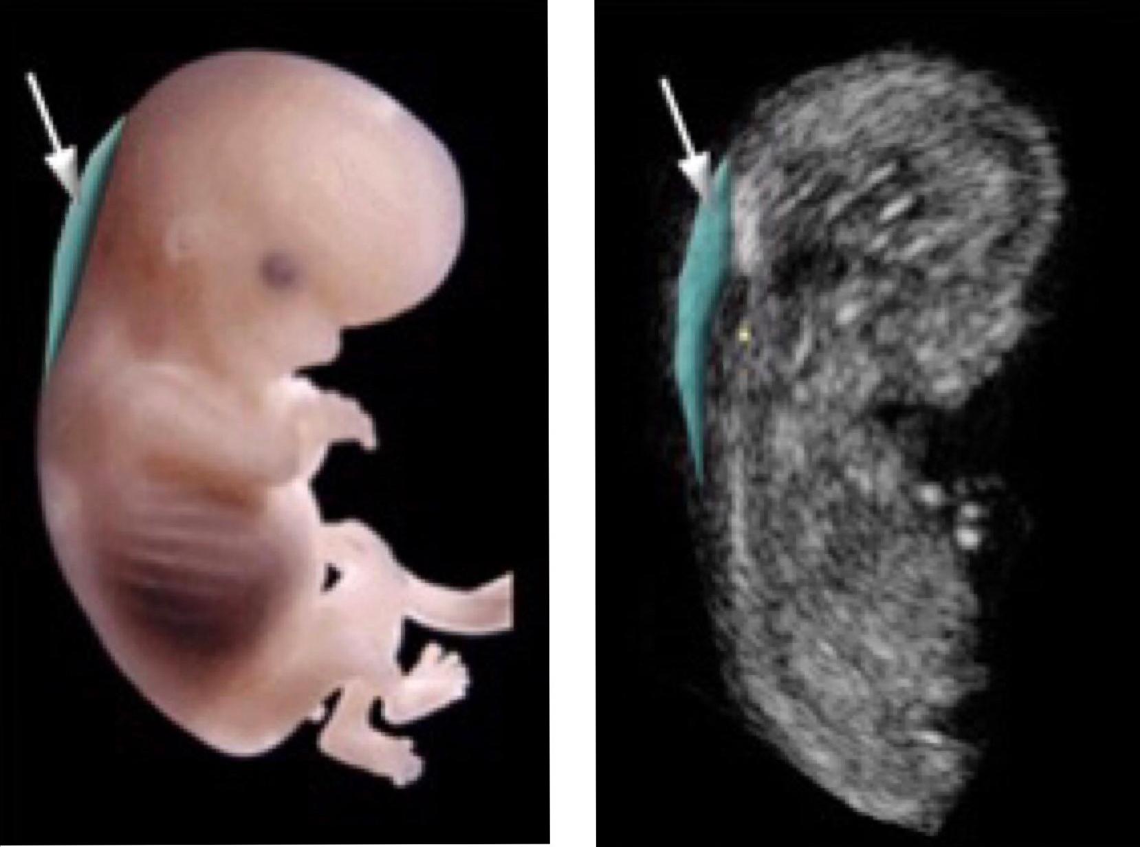 准妈妈要注意孕期常见疾病,准妈妈孕期注意事项