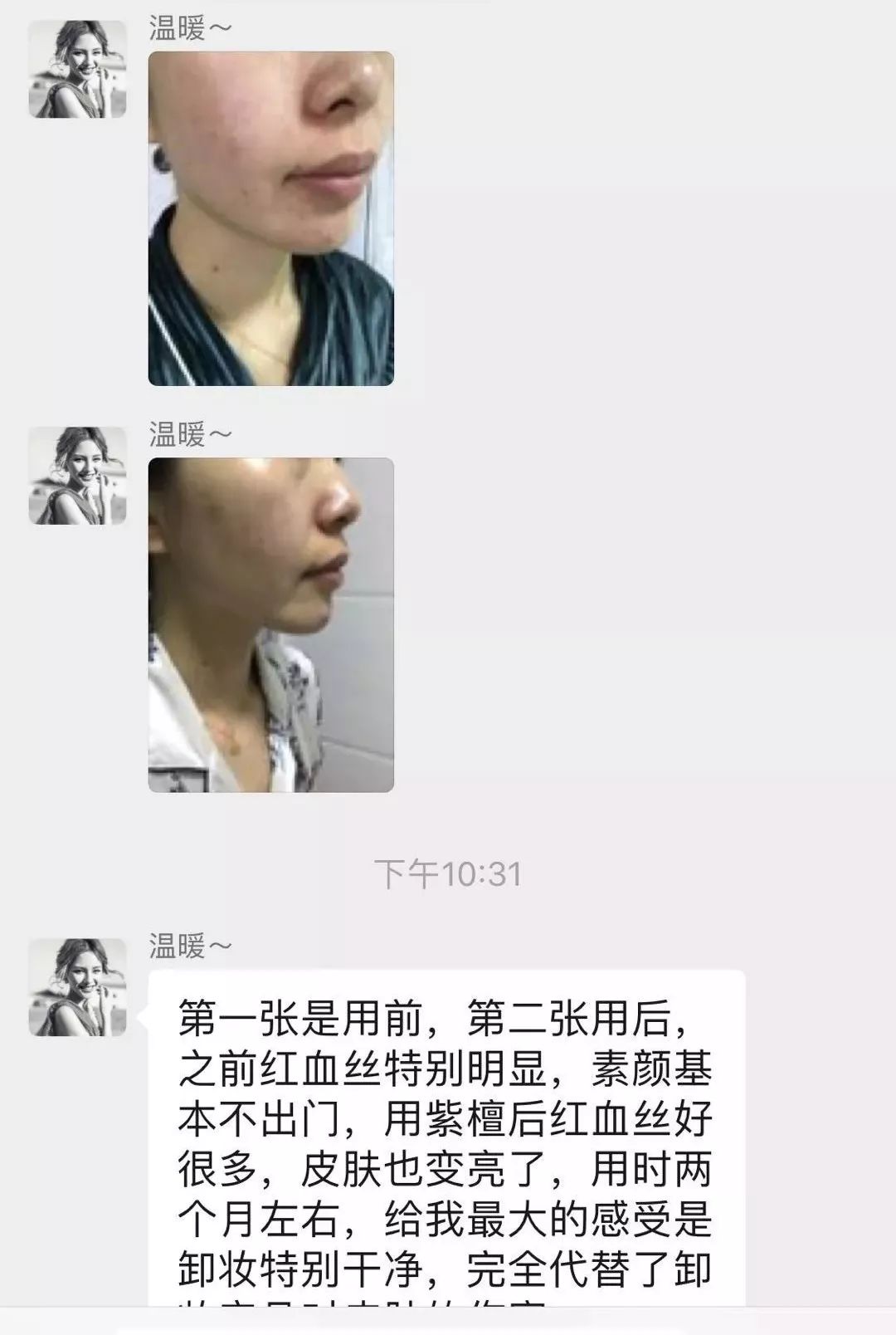 紫檀真的抗衰老吗,紫檀能扩香吗