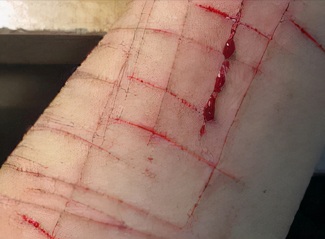 孩子有自残现象该不该跟老师讲,孩子自残的心理疏导