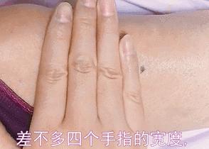 脱发掉发按什么穴位可以改善,45岁脱发掉发的穴位疗法