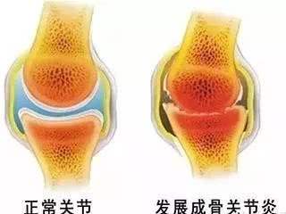 膝关节养护叫啥项目,膝关节受寒揉哪个穴位