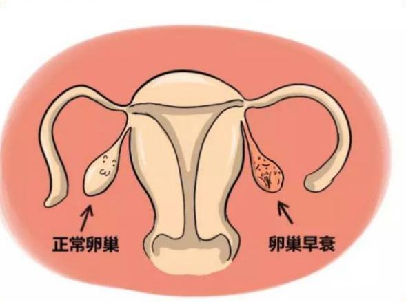 高龄产妇怀孕需要做的产检时间表,高龄产妇怎么怀上宝宝