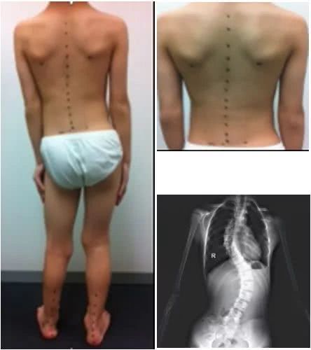 合脚不合脚只有自己知道,一般买多大码的鞋合适