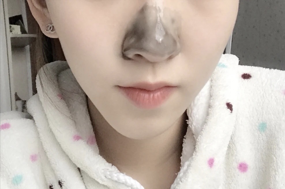 能消除黑头的简单又有效方法,酒糟鼻去黑头用什么洗面奶