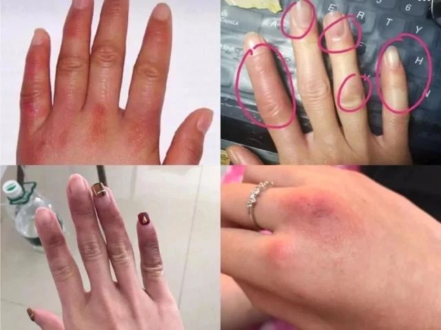 手模是怎么保护手的,手模是用什么做的