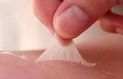 紫外线晒皮肤发红怎么办,紫外线晒得又红又痒怎么办