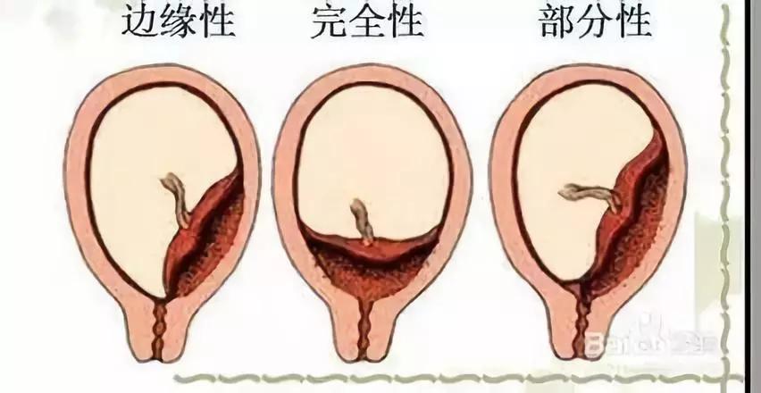 有哪些妇科疾病是正常的,你知道吗有些妇科病其实不用治