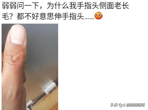 “为啥我大拇指侧面老长毛？”哈哈哈好家伙，你这还自带牙刷功能