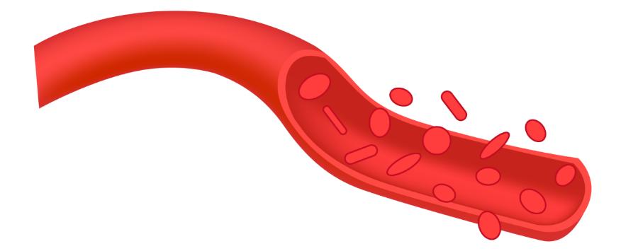 艾灸灸透是什么程度,灸法的真正原理