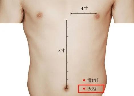 艾灸和拔罐哪个祛湿气效果好一些,三伏祛湿最有效的方法艾灸