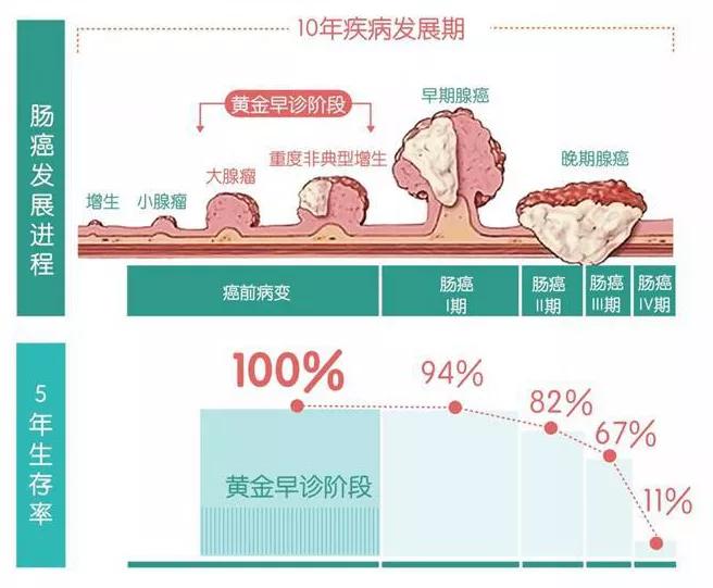 直肠癌中晚期手术费用,直肠癌中晚期能不能手术治疗