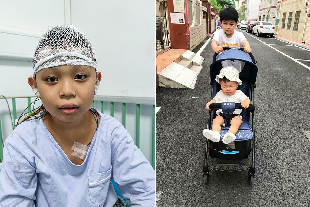 八岁男孩腋下好多红疙瘩,小朋友腋下有一片红疙瘩