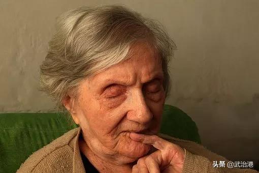 帕金森不能根治如何有效缓解,帕金森没法根治吗